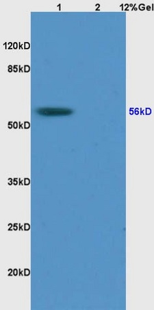 Lane 1: human colon carcinoma lysates Lane 2: rat brain lysates probed with Anti RCC2 Polyclonal Antibody, Unconjugated (bs-7768R) at 1:200 in 4˚C. Followed by conjugation to secondary antibody (bs-0295G-HRP) at 1:3000 90min in 37˚C. Predicted band 56kD. Observed band size: 56kD.