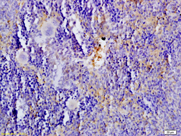 Formalin-fixed and paraffin embedded rat spleen tissue labeled with Anti-5-HTT\/SLC6A4 Polyclonal Antibody, Unconjugated (bs-1893R) at 1:200 followed by conjugation to the secondary antibody and DAB staining