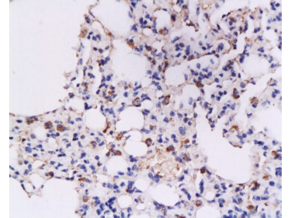 Formalin-fixed and paraffin embedded rat lung tissue labeled with Anti-IFN-gamma Polyclonal Antibody, Unconjugated (bs-0480R) at 1:200, followed by conjugation to the secondary antibody and DAB staining