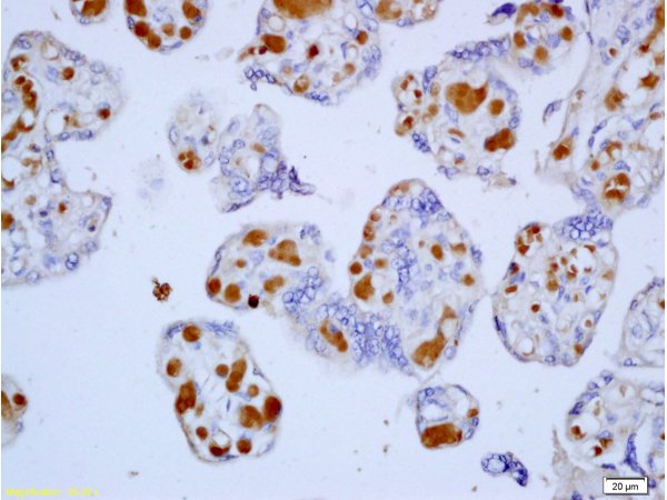 Formalin-fixed and paraffin embedded human placenta tissue labeled with Anti-Cyclin D1 Polyclonal Antibody, Unconjugated (bs-0623R) at 1:200, followed by conjugation to the secondary antibody and DAB staining