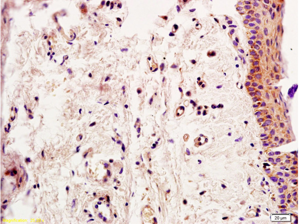 Formalin-fixed and paraffin embedded rat skin tissue labeled with Anti-Smad2 Polyclonal Antibody, Unconjugated (bs-0718R) at 1:200, followed by conjugation to the secondary antibody and DAB staining