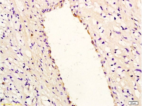Formalin-fixed and paraffin embedded rabbit carotid artery labeled with Anti-IL-8\/CXCL8 Polyclonal Antibody, Unconjugated (bs-0780R) at 1:200, followed by conjugation to the secondary antibody and DAB staining