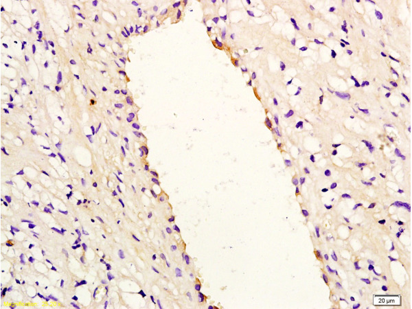 Formalin-fixed and paraffin embedded rabbit carotid artery labeled with Anti-IL-8/CXCL8 Polyclonal Antibody, Unconjugated (bs-0780R) at 1:200, followed by conjugation to the secondary antibody and DAB staining