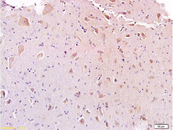Formalin-fixed and paraffin embedded rat spinal cord labeled with Anti-Galanin Polyclonal Antibody, Unconjugated (bs-0017M) at 1:200, followed by conjugation to the secondary antibody and DAB staining\\n