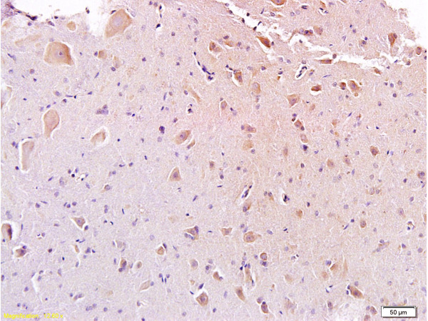 Formalin-fixed and paraffin embedded rat spinal cord labeled with Anti-Galanin Polyclonal Antibody, Unconjugated (bs-0017M) at 1:200, followed by conjugation to the secondary antibody and DAB stainingn