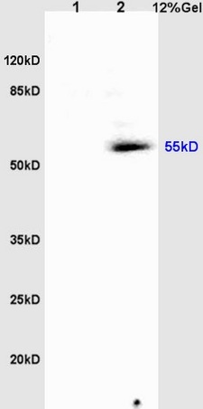 L1 rat heart lysates, L2 rat brain lysates probed: Anti-Tubulin-alpha (bs-0159R) at 1:200 in 4˚C. Followed by conjugation to secondary antibody (bs-0295G-HRP) at 1:3000 90min in 37˚C. Predicted and observed band size: 55kDa