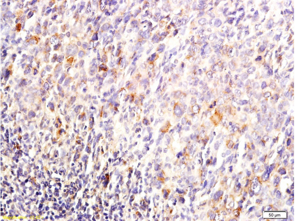 Formalin-fixed and paraffin embedded mouse lymphoma tissue labeled with Anti-DUSP1/MKP-1 Polyclonal Antibody, Unconjugated (bs-1851R) at 1:200, followed by conjugation to the secondary antibody and DAB staining