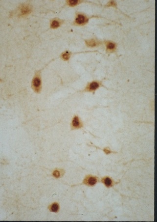 Frozen mouse hippocampus tissue labeled with Anti-Nurr1 Polyclonal Antibody, Unconjugated (bs-0178R) followed by conjugation to the secondary antibody