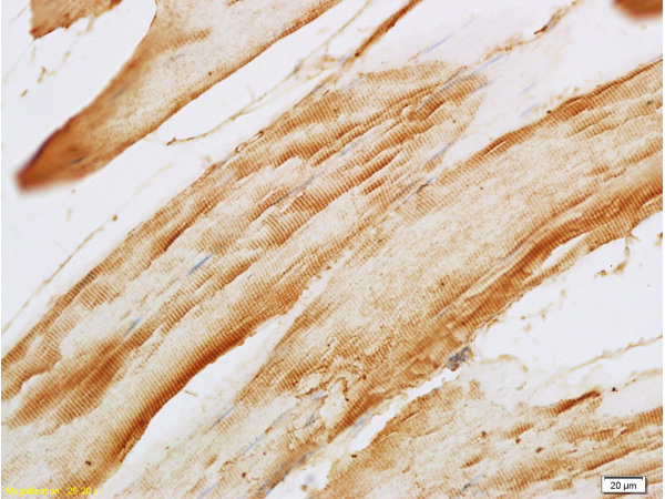 Formalin-fixed and paraffin embedded rat skeletal muscle labeled with Anti-F-Actin Polyclonal Antibody, Unconjugated (bs-1571R) at 1:200, followed by conjugation to the secondary antibody and DAB staining