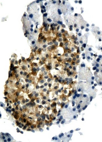 Formalin-fixed and paraffin embedded rat pancreas tissue labeled with Anti-IL-6 Polyclonal Antibody, Unconjugated (bs-0379R) followed by conjugation to the secondary antibody and DAB staining