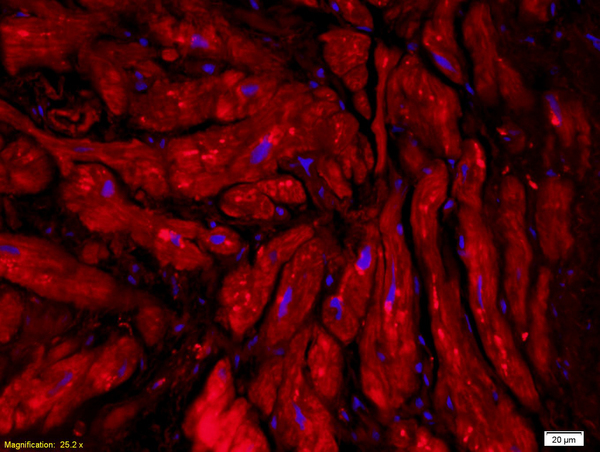Formalin-fixed and paraffin embedded human myocardial tissue labeled with Anti-CT-1/CTF1 Polyclonal Antibody, Unconjugated (bs-2534R) followed by conjugation to the secondary antibody and DAPI