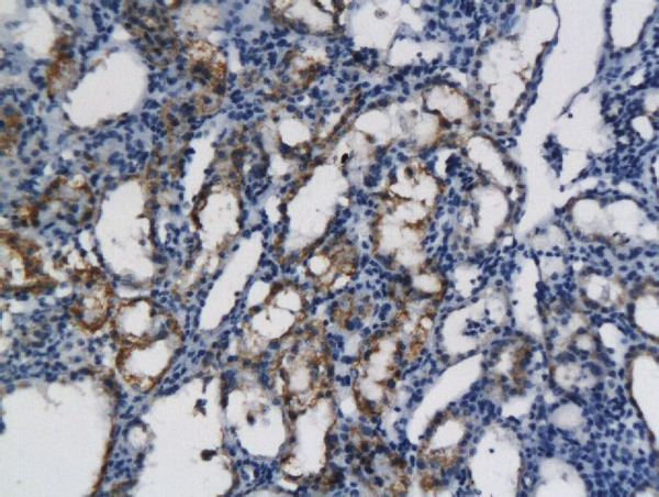Formalin-fixed and paraffin embedded rat kidney labeled with Anti- CXCL11 Polyclonal Antibody, Unconjugated (bs-2552R) followed by conjugation to the secondary antibody and DAB