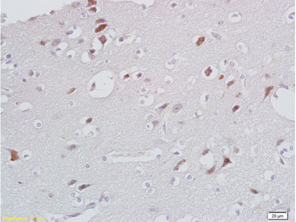 Formalin-fixed and paraffin embedded human brain labeled with Anti- CXCL13/BCA1 Polyclonal Antibody, Unconjugated (bs-2553R) at 1:200 followed by conjugation to the secondary antibody and DAB