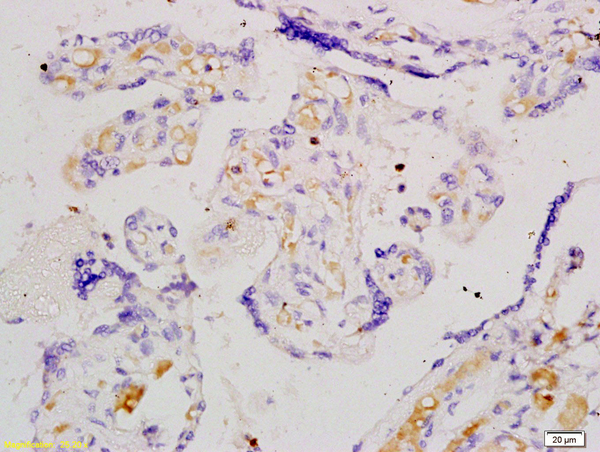 Formalin-fixed and paraffin embedded human placenta tissue labeled with Anti-Angiomotin Polyclonal Antibody, Unconjugated (bs-4171R) at 1:200 followed by conjugation to the secondary antibody and DAB staining