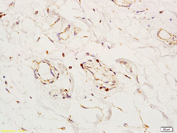 Formalin-fixed and paraffin embedded human colon tissue labeled with Anti-Angiomotin Polyclonal Antibody, Unconjugated (bs-4171R) at 1:200 followed by conjugation to the secondary antibody and DAB staining