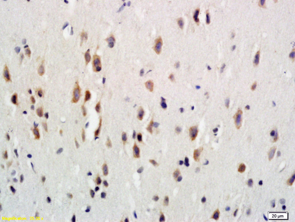 Formalin-fixed and paraffin embedded rat brain labeled with Anti-G-CSFR/CD114 Polyclonal Antibody, Unconjugated (bs-2574R) at 1:600 followed by conjugation to the secondary antibody and DAB staining