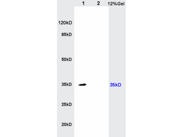 L1 rat kidney lysates and L2 rat brain lysates lysates probed with Anti- IL-17RB Polyclonal Antibody, Unconjugated (bs-2610R) at 1:200 in 4˚C. Followed by conjugation to secondary antibody (bs-0295G-HRP) at 1:3000 90min in 37˚C. Predicted band: 33kD/55kD Observed band size: 35kD