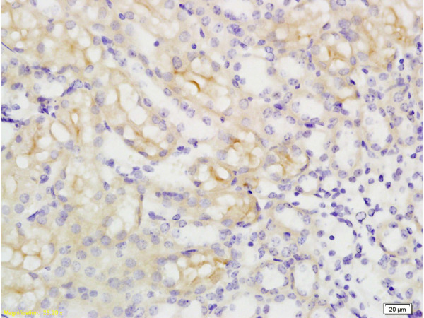 Formalin-fixed and paraffin embedded rat kidney tissue labeled with Anti-SLC16A3 Polyclonal Antibody, Unconjugated(bs-2698R) at 1:200 followed by conjugation to the secondary antibody and DAB staining