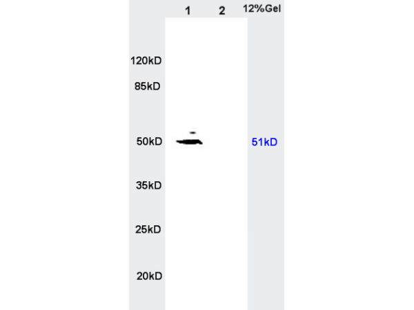 L1 rat kidney lysates, L2 rat brain lysates probed with Anti- SLC16A3/MCT4 Polyclonal Antibody, Unconjugated (bs-2698R) at 1:200 in 4˚C. Followed by conjugation to secondary antibody (bs-0295G-HRP) at 1:3000 90min in 37˚C. Predicted band and observed band size: 51kD
