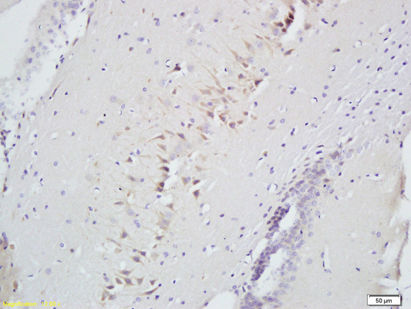 Formalin-fixed and paraffin embedded rat brain labeled with Anti-Slit2/Slil3 Polyclonal Antibody, Unconjugated (bs-2743R) at 1:300 followed by conjugation to the secondary antibody and DAB staining Formalin-fixed and paraffin embedded rat brain labeled with Anti-Slit2/Slil3 Polyclonal Antibody, Unconjugated (bs-2743R) at 1:300 followed by conjugation to the secondary antibody and DAB staining