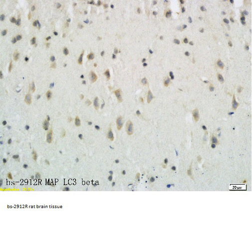 Formalin-fixed and paraffin embedded rat brain tissue labeled with Anti-LC3B/MAP LC3β/MAP1A Polyclonal Antibody, Unconjugated (bs-2912R) followed by conjugation to the secondary antibody and DAB staining