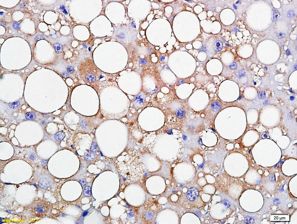 Formalin-fixed and paraffin embedded rat liver labeled with Anti-TIP47/M6PRBP1 Polyclonal Antibody, Unconjugated (bs-2914R) followed by conjugation to the secondary antibody and DAB staining