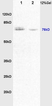 Lane 1: rat brain lysates Lane 2: rat lung lysates probed with Anti DVL1\/Dishevelled Polyclonal Antibody, Unconjugated (bs-0598R) at 1:200 in 4˚C. Followed by conjugation to secondary antibody (bs-0295G-HRP) at 1:3000 90min in 37˚C. Predicted band 76kD. Observed band size: 76kD.