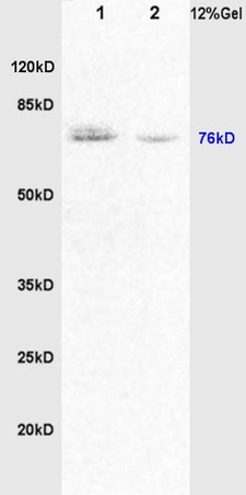 Lane 1: rat brain lysates Lane 2: rat lung lysates probed with Anti DVL1/Dishevelled Polyclonal Antibody, Unconjugated (bs-0598R) at 1:200 in 4˚C. Followed by conjugation to secondary antibody (bs-0295G-HRP) at 1:3000 90min in 37˚C. Predicted band 76kD. Observed band size: 76kD.
