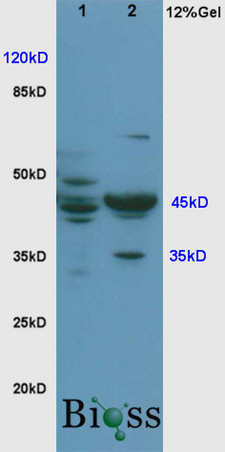 L1 rat brain, L2 rat lung lysates probed (bs-0573R) at 1:200 in 4˚C. Followed by conjugation to secondary antibody (bs-0295G-HRP) at 1:3000 90min in 37˚C. Predicted and observed band size: 45kDa.