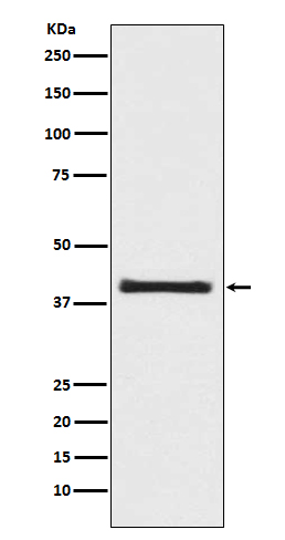 AKT1S1 Recombinant Antibody