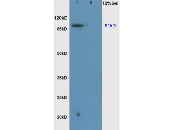 L1 rat brain, L2 rat liver lysates probed (bs-0505R) at 1:200 in 4˚C. Followed by conjugation to secondary antibody (bs-0295G-HRP) at 1:3000 90min in 37˚C. Predicted band and observed band size: 91kDa. L1 rat brain, L2 rat liver lysates probed (bs-0505R) at 1:200 in 4˚C. Followed by conjugation to secondary antibody (bs-0295G-HRP) at 1:3000 90min in 37˚C. Predicted band and observed band size: 91kDa.