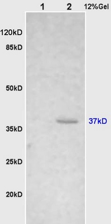 L1 rat brain, L2 human colon carcinoma lysates probed (bs-1670R) at 1:200 in 4˚C. Followed by conjugation to secondary antibody (bs-0295G-HRP) at 1:3000 90min in 37˚C. Predicted and observed band size: 37kDa.