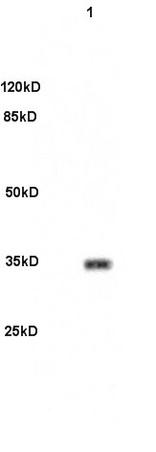 Mouse brain lysates 30ug, probed (bs-2364R) at 1:200 overnight in 4˚C. Followed by conjugation to the secondary antibody (bs-0295G-HRP) at 1:3000 90min in 37˚C. Predicted and observed band size: 33kDa.
