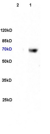L1 rat brain, L2 human colon carcinoma lysates probed (bs-2537R) at 1:200 in 4˚C. Followed by conjugation to secondary antibody (bs-0295G-HRP) at 1:3000 90min in 37˚C. Predicted and observed band size: 70kDa.