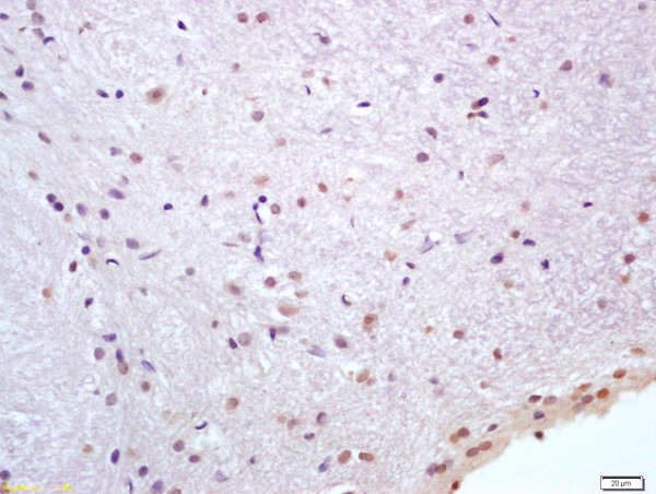 Formalin-fixed and paraffin embedded rat brain labeled with Anti-HSP70\/HSPA1A Polyclonal Antibody, Unconjugated (bs-0244R) at 1:200 followed by conjugation to the secondary antibody and DAB staining