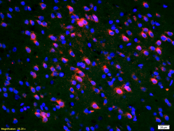 Formalin-fixed and paraffin-embedded rat brain labeled with Anti-Deltex 1 Polyclonal Antibody, Unconjugated(bs-0399R) 1:200, overnight at 4\u00b0C, The secondary antibody was Goat Anti-Rabbit IgG, Cy3 conjugated(bs-0295G-Cy3)used at 1:200 dilution for 40 minutes at 37\u00b0C.DAPI was used to stain the cell nuclei
