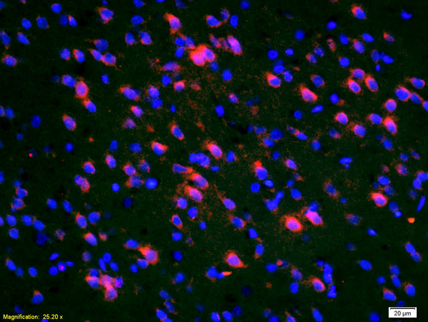 Formalin-fixed and paraffin-embedded rat brain labeled with Anti-Deltex 1 Polyclonal Antibody, Unconjugated(bs-0399R) 1:200, overnight at 4°C, The secondary antibody was Goat Anti-Rabbit IgG, Cy3 conjugated(bs-0295G-Cy3)used at 1:200 dilution for 40 minutes at 37°C.DAPI was used to stain the cell nuclei