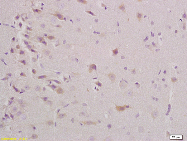 Formalin-fixed and paraffin embedded rat brain labeled with Anti-Triosephosphate isomerase Polyclonal Antibody, Unconjugated (bs-4042R) at 1:200 followed by conjugation to the secondary antibody and DAB staining