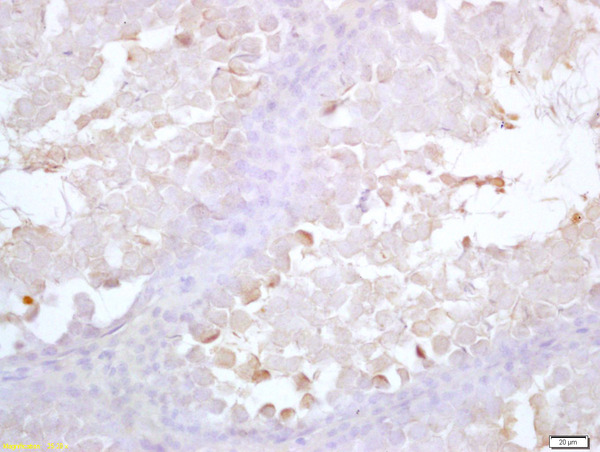 Formalin-fixed and paraffin embedded rat testis labeled with Anti-Acrosin Polyclonal Antibody, Unconjugated (bs-5151R) at 1:200 followed by conjugation to the secondary antibody and DAB staining