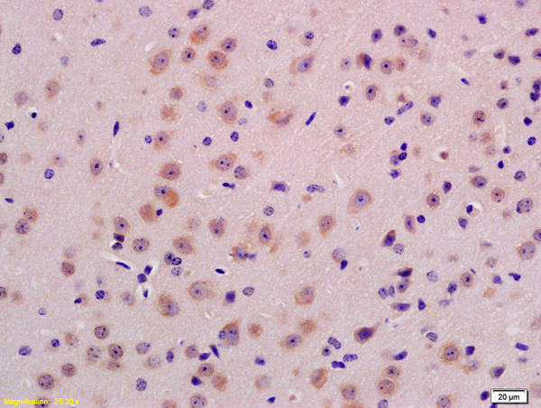 Formalin-fixed and paraffin embedded mouse brain labeled with Anti-PPT1 Polyclonal Antibody, Unconjugated (bs-6619R) at 1:200 followed by conjugation to the secondary antibody and DAB staining