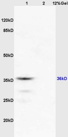 Lane 1: mouse brain lysates Lane 2: mouse kidney lysates probed with Anti RASSF2 Polyclonal Antibody, Unconjugated (bs-2939R) at 1:200 in 4˚C. Followed by conjugation to secondary antibody (bs-0295G-HRP) at 1:3000 90min in 37˚C. Predicted band 36kD. Observed band size: 36kD. Lane 1: mouse brain lysates Lane 2: mouse kidney lysates probed with Anti RASSF2 Polyclonal Antibody, Unconjugated (bs-2939R) at 1:200 in 4˚C. Followed by conjugation to secondary antibody (bs-0295G-HRP) at 1:3000 90min in 37˚C. Predicted band 36kD. Observed band size: 36kD.
