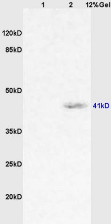 Lane 1: rat lung lysates Lane 2: human colon carcinoma lysates probed with Anti CD64\/IGFR1\/FCGR1A Polyclonal Antibody, Unconjugated (bs-1251R) at 1:200 in 4˚C. Followed by conjugation to secondary antibody (bs-0295G-HRP) at 1:3000 90min in 37˚C. Predicted band 41kD. Observed band size: 41kD.