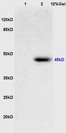 Lane 1: mouse brain lysates Lane 2: human colon carcinoma lysates probed with Anti PIM1 Polyclonal Antibody, Unconjugated (bs-3540R) at 1:200 in 4˚C. Followed by conjugation to secondary antibody (bs-0295G-HRP) at 1:3000 90min in 37˚C. Predicted band 45kD. Observed band size: 45kD.