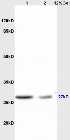Lane 1: mouse brain lysates Lane 2: mouse liver lysates probed with Anti RPS6Polyclonal Antibody, Unconjugated (bs-3565R) at 1:200 in 4˚C. Followed by conjugation to secondary antibody (bs-0295G-HRP) at 1:3000 90min in 37˚C. Predicted band 27kD. Observed band size: 27kD.\n