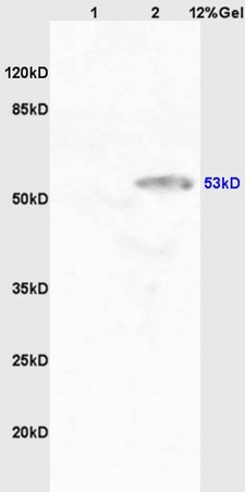 Lane 1: mouse kidney lysates Lane 2: human kidney lysates probed with Anti CYP11A1/P450SCC Polyclonal Antibody, Unconjugated (bs-3608R) at 1:200 in 4˚C. Followed by conjugation to secondary antibody (bs-0295G-HRP) at 1:3000 90min in 37˚C. Predicted band 53/57kD. Observed band size: 53kD.\n
