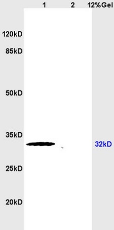 Lane 1: rat heart lysates Lane 2: rat brain lysates probed with Anti APG5L/ATG5 Polyclonal Antibody, Unconjugated (bs-4005R) at 1:200 in 4˚C. Followed by conjugation to secondary antibody (bs-0295G-HRP) at 1:3000 90min in 37˚C. Predicted band 32kD. Observed band size: 32kD.\n