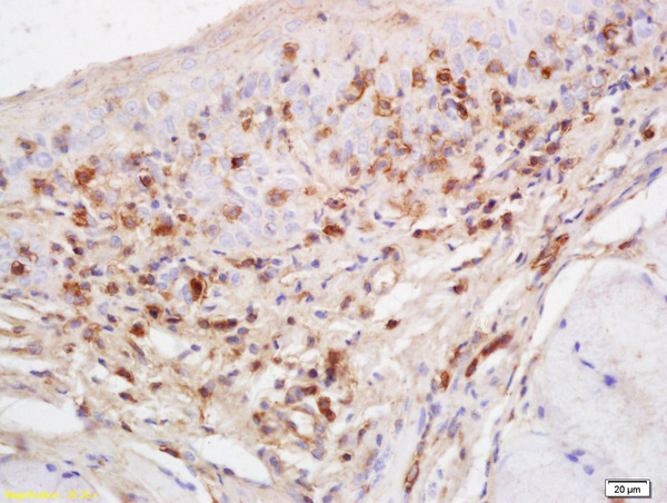 Formalin-fixed and paraffin embedded rat tongue labeled with Anti-RASA3 Polyclonal Antibody, Unconjugated (bs-5954R) at 1:200 followed by conjugation to the secondary antibody and DAB staining
