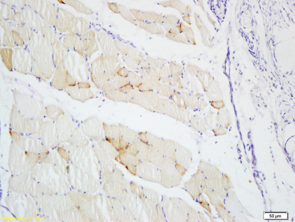 Formalin-fixed and paraffin embedded rat skin labeled with Anti-S100A4 Polyclonal Antibody, Unconjugated (bs-3759R) at 1:200 followed by conjugation to the secondary antibody and DAB staining