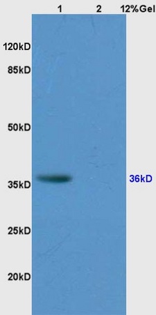 Lane 1: human colon carcinoma Lane 2: rat kidney lysates probed with Anti CD34 Polyclonal Antibody, Unconjugated (bs-2038R) at 1:200 in 4˚C. Followed by conjugation to secondary antibody (bs-0295G-HRP) at 1:3000 90min in 37˚C. Predicted band 39kD. Observed band size: 39kD.