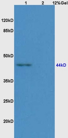 Lane 1: mouse embryo lysates Lane 2: rat brain lysates probed with Anti AVPR2 Polyclonal Antibody, Unconjugated (bs-2239R) at 1:200 in 4˚C. Followed by conjugation to secondary antibody (bs-0295G-HRP) at 1:3000 90min in 37˚C. Predicted band 45kD. Observed band size: 45kD.